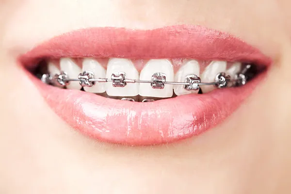 Dr Sophie CESARO - Soins dentaires et Orthodontie_Trouillas_slider_immagine_2