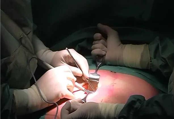 Dr. Peter Van De Walle Chirurgien viscéral et digestif doctor en Grâces