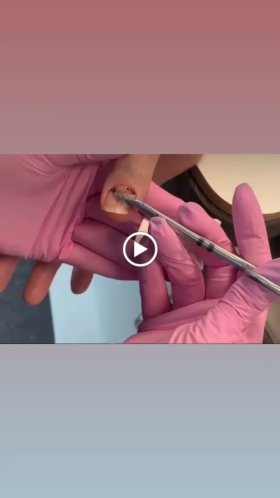 FANCY Fachpraxis für professionelle Fußpflege in Senden_Senden_slider_immagine_3