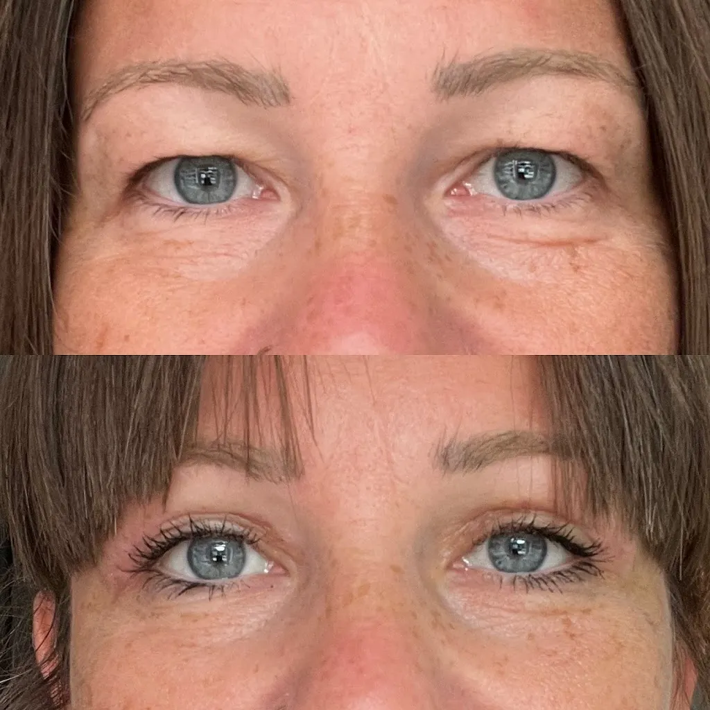 Nadine W._Klinik am Schwarzwald - Plastische Chirurgie Dr. Holdenried_Lauchringen_avis