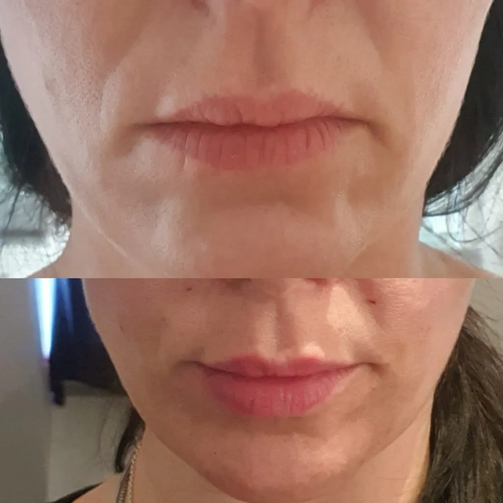 Mia_Link Aesthetik: fachärztliche Praxis für Health+Beauty_Kleinostheim_bewertung