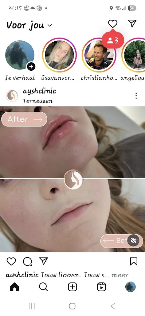 AyshClinic Terneuzen: Schoonheid & Injectables in Terneuzen