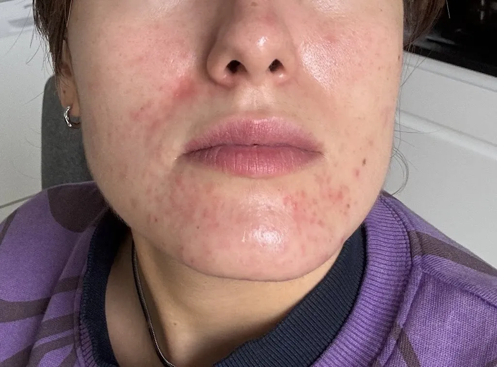 Fisioterapia Natalia Torrejón in Esquivias