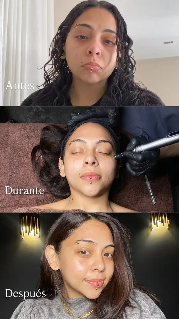 Clínicas de Medicina Estética en Valencia | Clínica Belice in Beniparrell