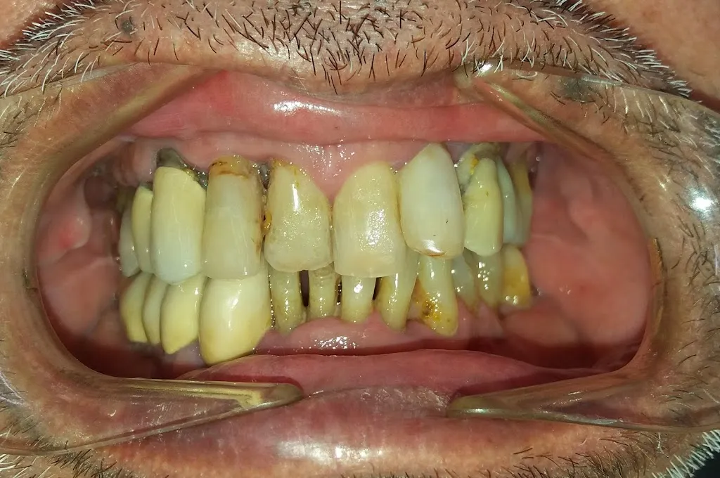 Clinica Dental Pere Alcantara in Massamagrell