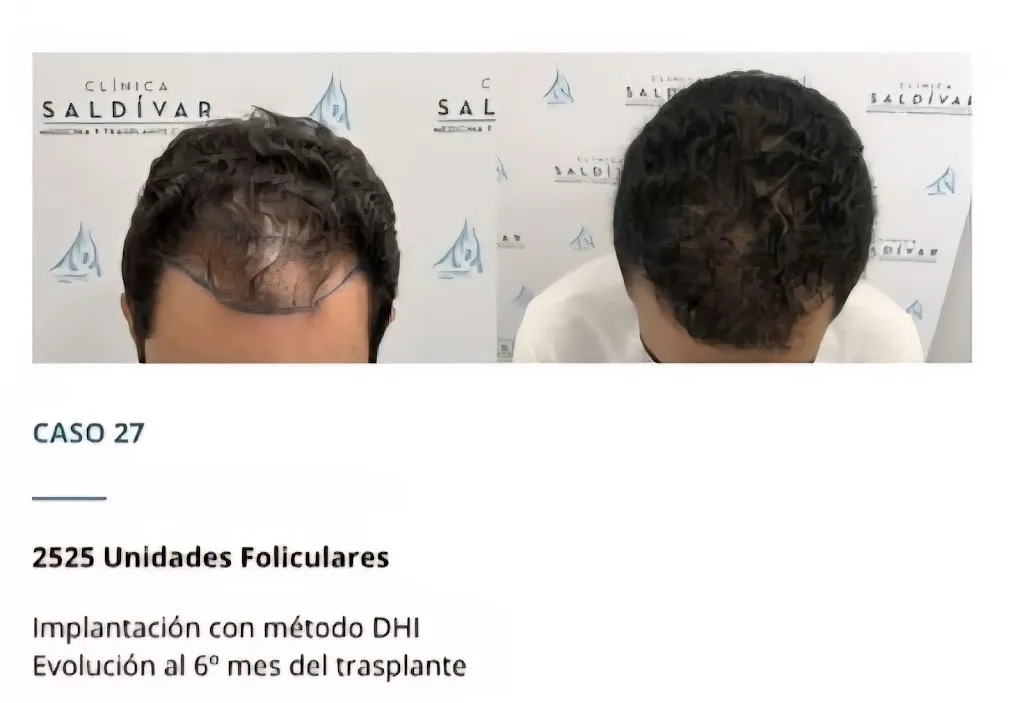 Clínica Saldívar I Centro Médico Capilar Ciudad Real in Abenójar