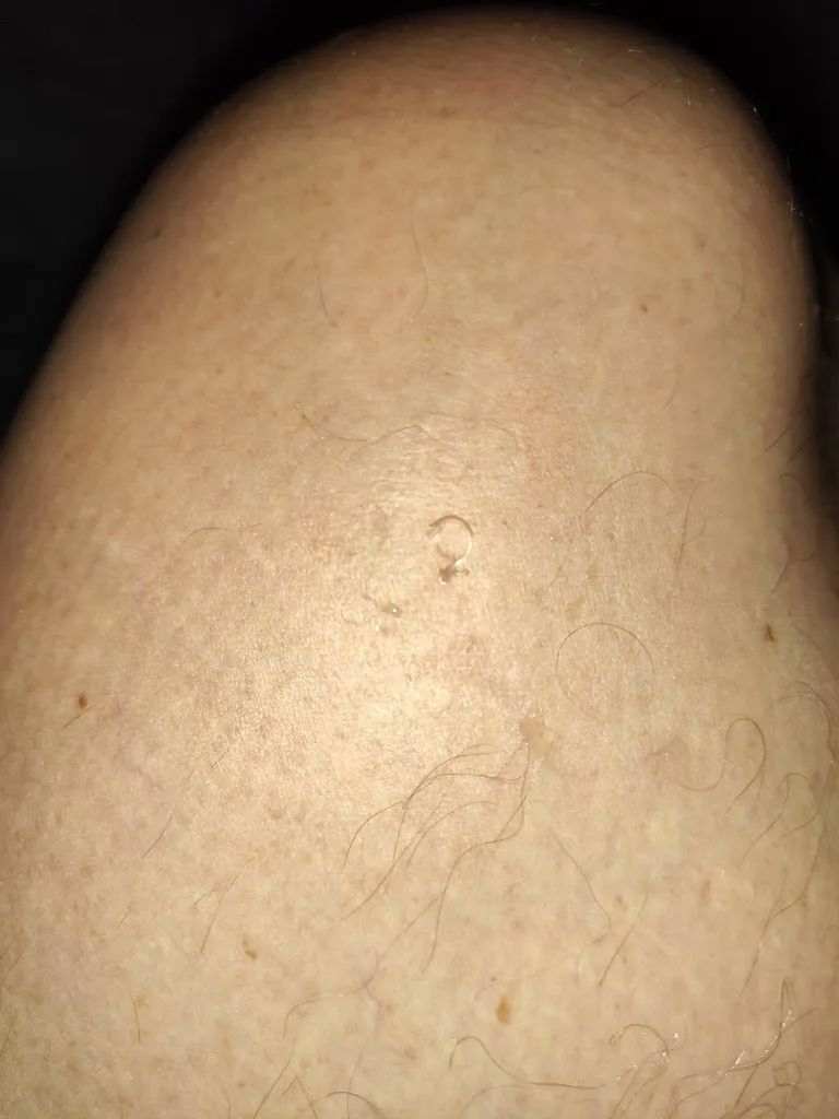 michel miege_Cabinet de Dermatologie de Versoix_Versoix_reseña