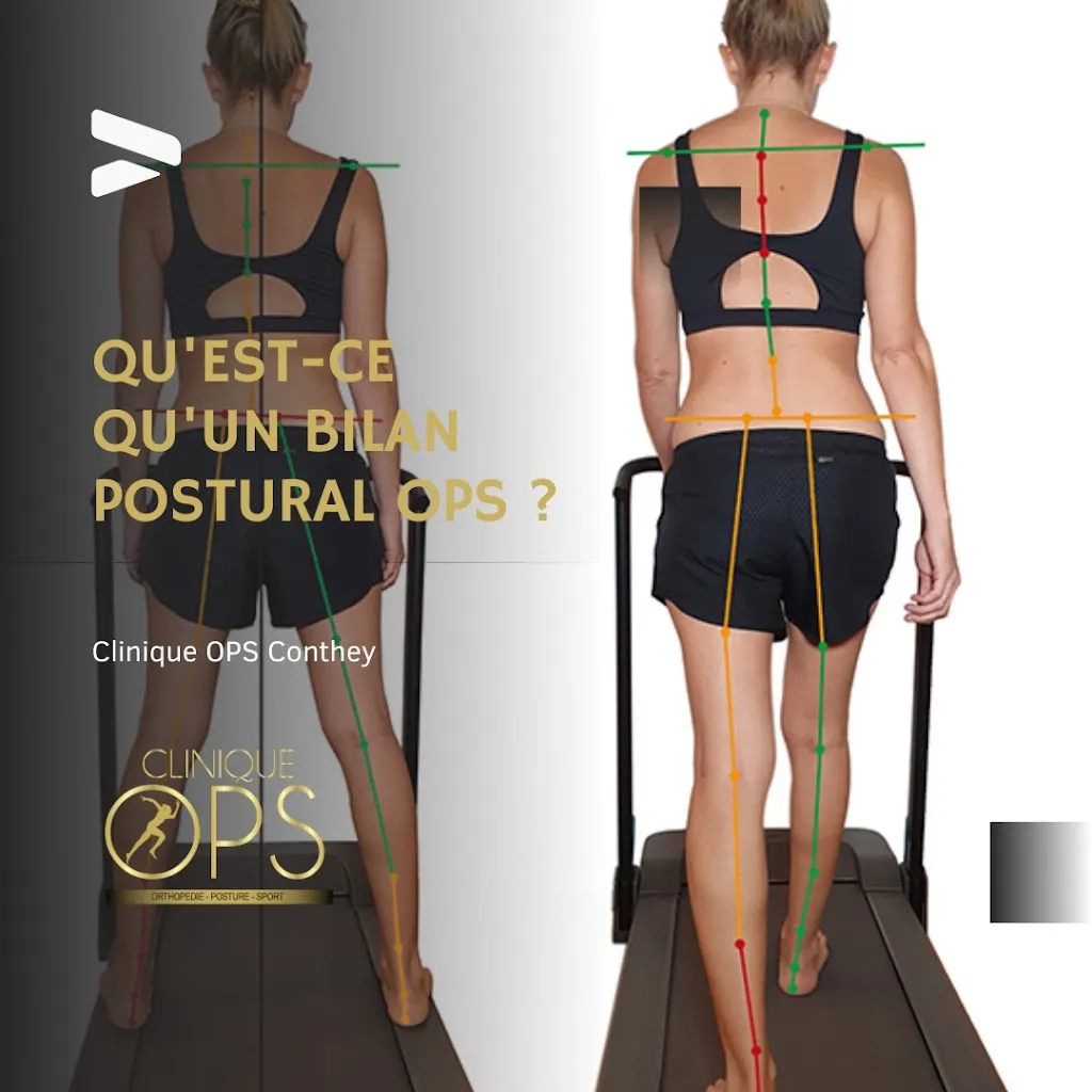 Cabinet OPS Conthey - Orthopédie Posture Sport - Conthey : posturologie, semelles orthopédiques actives_Savièse_slider_bild_3