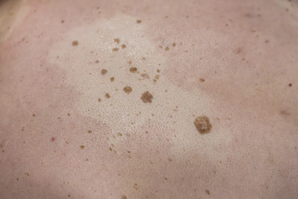 Eccleshall Dermatology Clinic in Eccleshall