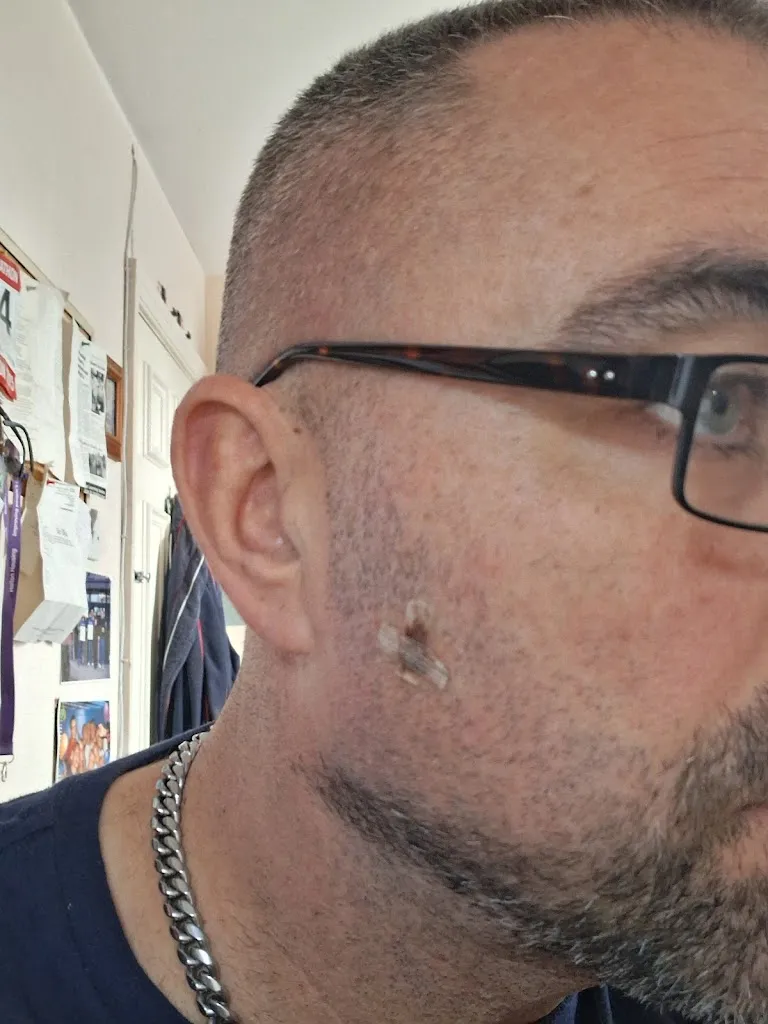 Skin and Joint Injection Clinic in Bebington