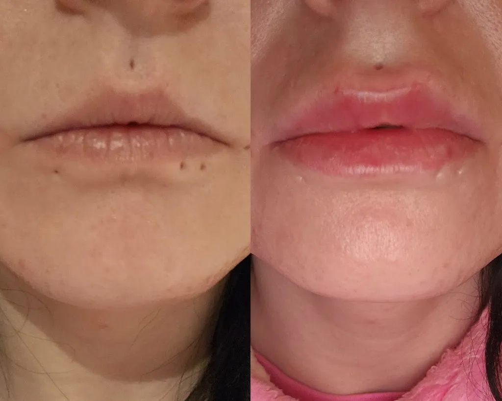 Halo Aesthetics Wellness And Trauma Clinic in Merthyr Tydfil