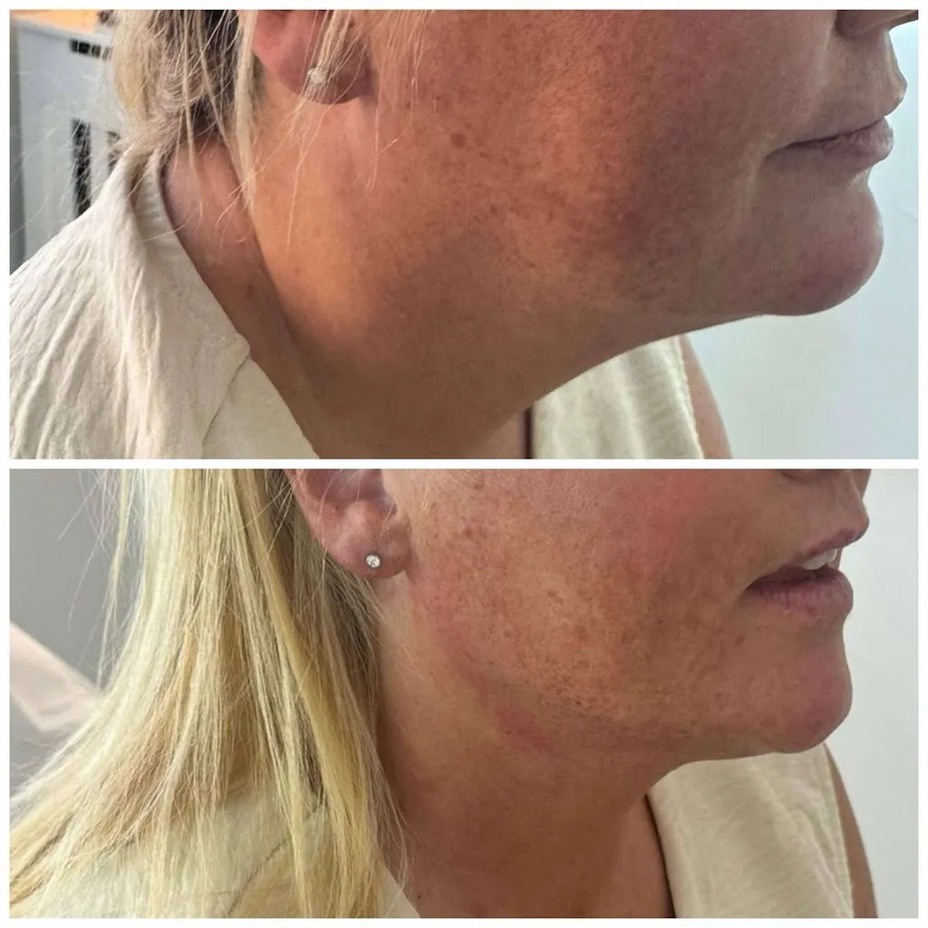 Halo Aesthetics Wellness And Trauma Clinic_image_3