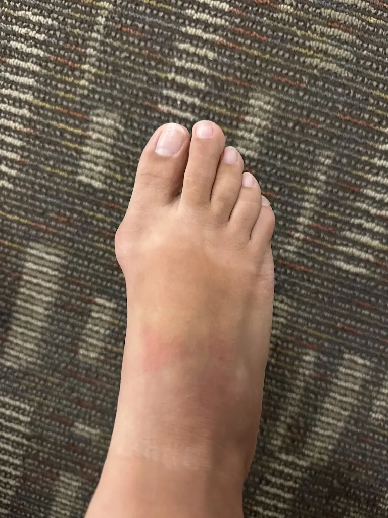 Crysalyn Lopez_Issaquah Foot & Ankle Specialists_White Center, Washington_avis
