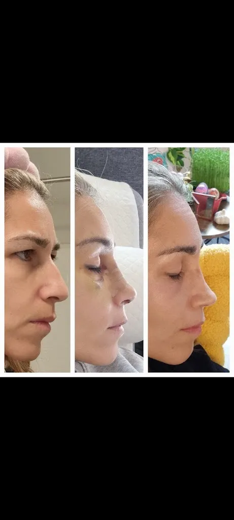 Shadi Golzarpour_Ranch & Coast Plastic Surgery | Dr. Paul Chasan_Del Mar, California_reseña
